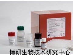 人白细胞共同抗原ELISA试剂盒_供应产品_博研生物技术研究中心
